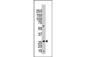 The YWHAZ polyclonal antibody  is used in Western blot to detect YWHAZ in Jurkat cell lysate. (14-3-3 zeta 抗体  (C-Term))
