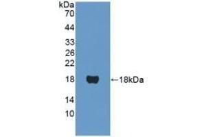 Detection of Recombinant PPARa, Human using Polyclonal Antibody to Peroxisome Proliferator Activated Receptor Alpha (PPARa) (PPARA 抗体  (AA 61-170))
