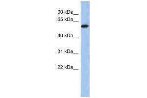 WB Suggested Anti-ZNF496 Antibody Titration: 0. (ZNF496 抗体  (Middle Region))