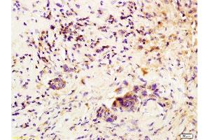 Immunohistochemistry (Paraffin-embedded Sections) (IHC (p)) image for anti-Colony Stimulating Factor 3 (Granulocyte) (CSF3) (AA 155-198) antibody (ABIN736521) (G-CSF 抗体  (AA 155-198))