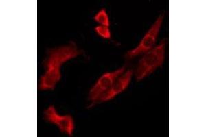 ABIN6276244 staining MCF7 by IF/ICC. (OR10J3 抗体  (Internal Region))