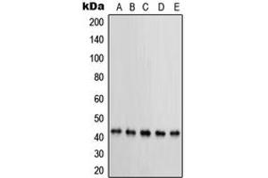 Western blot analysis of PRKAR1B expression in MCF7 (A), KNRK (B), NIH3T3 (C), HeLa (D), BT20 (E) whole cell lysates. (PRKAR1B 抗体  (Center))