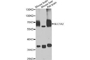 Western blot analysis of extracts of various cell lines, using SLC1A2 antibody (ABIN5995519) at 1/1000 dilution. (SLC1A2 抗体)