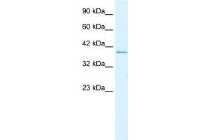 WB Suggested Anti-RIMS3 Antibody Titration:  1. (RIMS3 抗体  (C-Term))