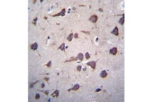 Immunohistochemistry analysis in formalin fixed and paraffin embedded human brain tissue reacted with Fukutin Antibody (Center) followed by peroxidase conjugation of the secondary antibody and DAB staining. (Fukutin 抗体  (Middle Region))