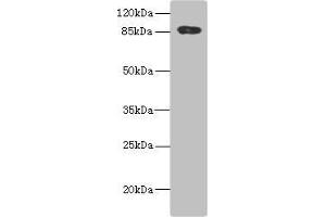 Western blot All lanes: ADAM28 antibody IgG at 5. (ADAM28 抗体  (AA 199-440))