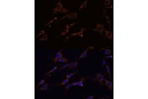 Immunofluorescence analysis of C6 cells using RPL7A Polyclonal Antibody (ABIN6128657, ABIN6147150, ABIN6147152 and ABIN6217809) at dilution of 1:100 (40x lens). (RPL7A 抗体  (AA 1-266))