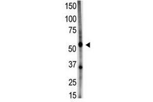 Image no. 1 for anti-Growth Differentiation Factor 5 (GDF5) (N-Term) antibody (ABIN357461) (GDF5 抗体  (N-Term))