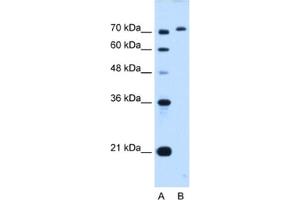Western Blotting (WB) image for anti-GPI Anchor Attachment Protein 1 (GPAA1) antibody (ABIN2462976) (GPAA1 抗体)
