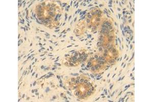 IHC-P analysis of Kidney tissue, with DAB staining. (GDF9 抗体  (AA 306-440))