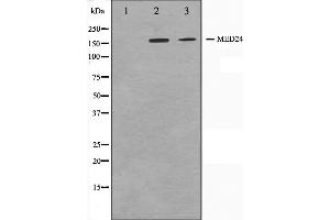 Western blot analysis on A549 and HuvEc cell lysate using MED24 Antibody,The lane on the left is treated with the antigen-specific peptide. (MED24 抗体  (C-Term))