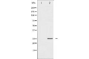 Western blot analysis of p21 Cip1 expression in EGF treated HeLa whole cell lysates,The lane on the left is treated with the antigen-specific peptide. (p21 抗体  (C-Term))
