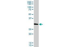 Western Blotting (WB) image for anti-Proliferating Cell Nuclear Antigen (PCNA) (AA 1-261) antibody (ABIN562136)