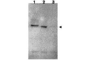 Western blot using  affinity purified anti-RNF25 antibody shows detection of RNF25 (arrow head) in HEK293 cells over-expressing human RNF25 (lane 1) or mouse RNF25 (lane 2). (RNF25 抗体  (C-Term))