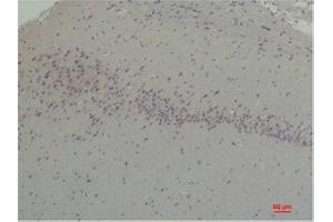 Immunohistochemistry (IHC) analysis of paraffin-embedded Rat Brain Tissue using CABP2 Rabbit Polyclonal Antibody diluted at 1:200. (CABP2 抗体)