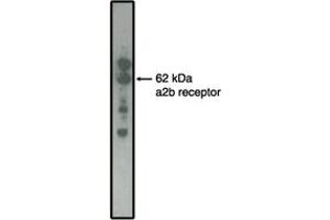 Image no. 1 for anti-Adrenergic, alpha-2B-, Receptor (ADRA2B) antibody (ABIN201731) (ADRA2B 抗体)