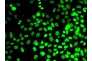 Immunofluorescence analysis of MCF7 cells using RP antibody (ABIN6128655, ABIN6147086, ABIN6147088 and ABIN6222439). (RPA3 抗体  (AA 6-121))