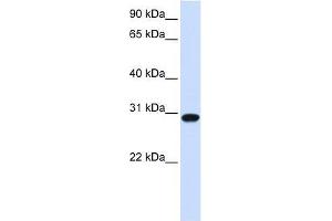FOXR1 antibody used at 0. (FOXR1 抗体  (N-Term))