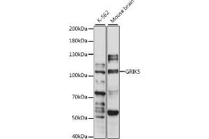 Western blot analysis of extracts of various cell lines, using GRIK5 antibody (ABIN7267416) at 1:1000 dilution.