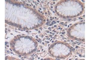 Immunohistochemistry (IHC) image for anti-Proprotein Convertase Subtilisin/kexin Type 5 (PCSK5) (AA 115-454) antibody (ABIN7435742)