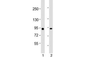 Western blot testing of human 1) Raji and 2) HeLa cell lysate with MYBL2 antibody at 1:2000. (MYBL2 抗体  (AA 245-278))