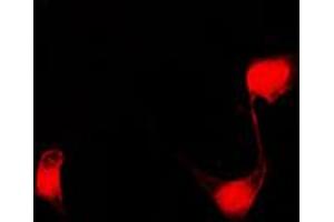 Immunofluorescent analysis of PPHLN1 staining in COLO205 cells. (PPHLN1 抗体  (Center))
