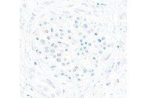 Immunohistochemistry (IHC) image for anti-Transcription Factor MafA (MAFA) (AA 125-175) antibody (ABIN7449538)