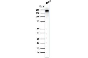 Western Blot Analysis of human Brain tissue lysate using Neurofilament Mouse Monoclonal Antibody (NE14). (NEFH 抗体)