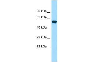 Western Blotting (WB) image for anti-Phosphatidylinositol-4-Phosphate 5-Kinase, Type I, beta (PIP5K1B) (C-Term) antibody (ABIN2790492)
