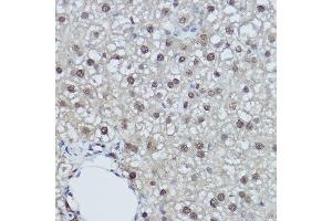 Immunohistochemistry of paraffin-embedded rat liver using DDB1 Rabbit pAb (ABIN1679509, ABIN5664466, ABIN5664468 and ABIN6220382) at dilution of 1:350 (40x lens). (DDB1 抗体  (C-Term))
