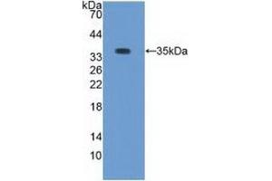 Western blot analysis of recombinant Rabbit PKCb1. (Pkc beta 1 抗体)