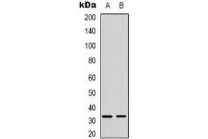 Western blot analysis of FOXE3 expression in SHSYSY (A), MDAMB435 (B) whole cell lysates. (FOXE3 抗体)