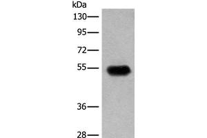 Western blot analysis of Human fetal brain tissue lysate using CDT1 Polyclonal Antibody at dilution of 1:400 (CDT1 抗体)
