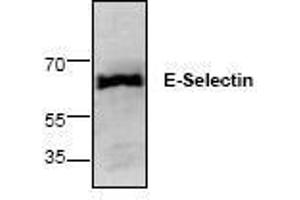 Image no. 1 for anti-Selectin E (SELE) antibody (ABIN127258)