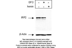 Image no. 1 for anti-Iron-Responsive Element Binding Protein 2 (IREB2) antibody (ABIN363497) (IREB2 抗体)