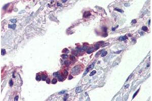 Human Lung, Respiratory Epithelium (formalin-fixed, paraffin-embedded) stained with PLUNC antibody ABIN462235 followed by biotinylated goat anti-rabbit IgG secondary antibody ABIN481713, alkaline phosphatase-streptavidin and chromogen. (BPIFA1 抗体  (AA 101-150))