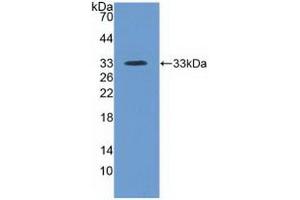 Detection of Recombinant ITIH4, Human using Polyclonal Antibody to Inter Alpha-Globulin Inhibitor H4 (ITIH4) (ITIH4 抗体  (AA 683-928))