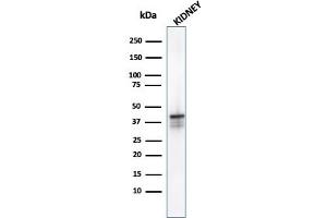 Western Blot analysis of Kidney tissue lysate using AMACR Mouse Monoclonal Antibody (AMACR/1723). (AMACR 抗体)