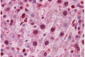 Human Liver: Formalin-Fixed, Paraffin-Embedded (FFPE) (HNF4A 抗体  (C-Term))