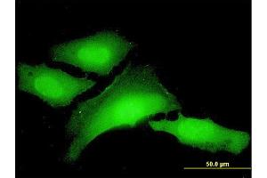 Immunofluorescence of monoclonal antibody to PCBP1 on HeLa cell. (PCBP1 抗体  (AA 181-280))