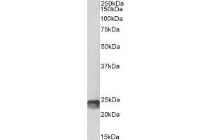 Biotinylated ABIN5539590 (1µg/ml) staining of Mouse Spleen lysate (35µg protein in RIPA buffer). (SOCS1 抗体  (C-Term) (Biotin))