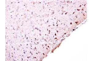 IHC-P Image PFKFB4 antibody [N3C3] detects PFKFB4 protein at cytosol on mouse middle brain by immunohistochemical analysis. (PFKFB4 抗体)