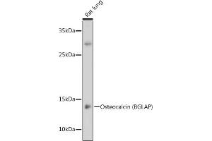 Western blot analysis of extracts of Rat lung, using Osteocalcin (BGLAP) antibody (ABIN6134565, ABIN6137546, ABIN6137547 and ABIN6221793) at 1:1000 dilution. (Osteocalcin 抗体  (AA 1-100))