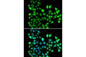 Immunofluorescence analysis of MCF-7 cells using SNRPD2 antibody. (SNRPD2 抗体)