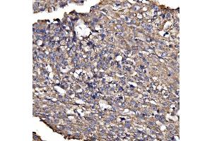 IHC analysis of BRSK1 using anti-BRSK1 antibody (ABIN7600990). (BRSK1 抗体  (AA 269-321))