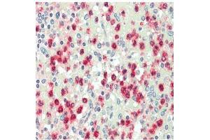 Immunohistochemistry analysis of Cathepsin G Antibody in paraffin-embedded human spleen tissue at 1/100. (Cathepsin G 抗体)