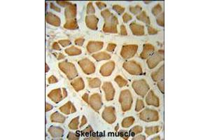DHRS7 Antibody immunohistochemistry analysis in formalin fixed and paraffin embedded human skeletal muscle followed by peroxidase conjugation of the secondary antibody and DAB staining.