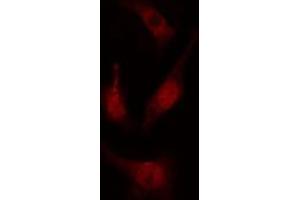 ABIN6274699 staining COLO205 cells by IF/ICC. (PRP19 抗体  (N-Term))