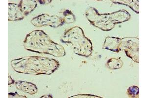 Immunohistochemistry of paraffin-embedded human placenta tissue using ABIN7176567 at dilution of 1:100 (AEBP2 抗体  (AA 248-517))