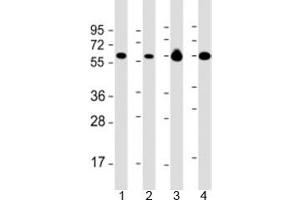 Western blot testing of 1) Daudi, 2) HL-60 cell lysate, 3) human brain and 4) mouse brain lysate with PACSIN2 antibody at 1:2000. (PACSIN2 抗体  (AA 250-486))